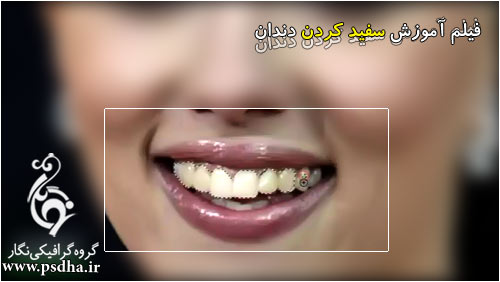  آموزش سفید کردن دندان در فتوشاپ