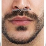 آموزش فتوشاپ اتلیه | ایجاد ریش